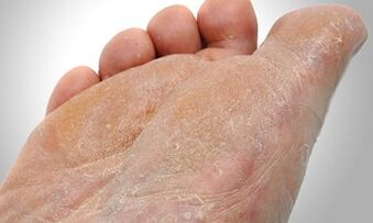 Caminhos de transmissão de fungos do pé